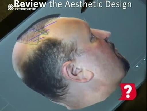 Imagem do Programa / Episiódio - Sabia Que? - Tecnologia Robótica Transplante Capilar