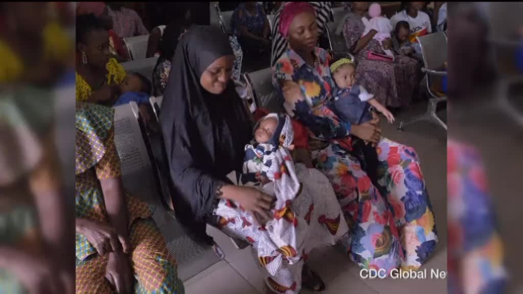 Imagem de Pólio: O Caminho Para a Erradicação