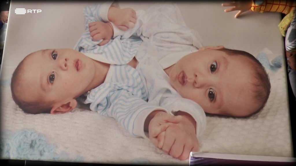 Imagem de Sim, Eu Consigo - Hassan e Hussein ligados à Nascença