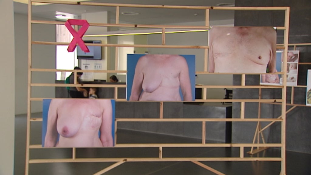 Exposição de Fotografia: Cancro da Mama