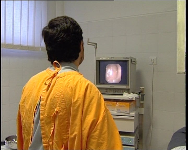 Cancro do cólon e do reto