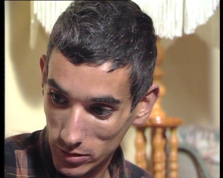 Hemodialisados aguardam indemnizações