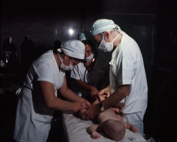 Operação cirúrgica de separação de gémeas siamesas