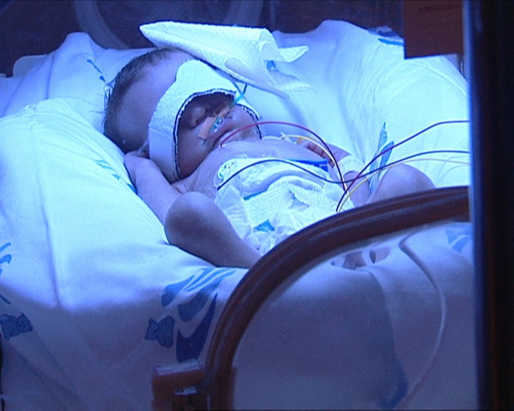 Nascimento de bebés prematuros em Portugal