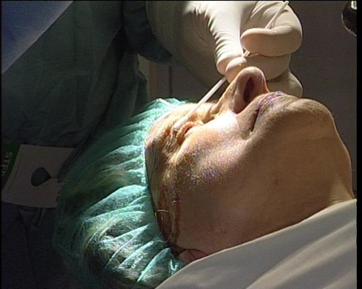 Indemnizações para as vítimas de intervenção cirúrgica