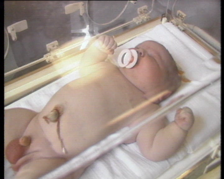 Bebé com 7,3 quilos