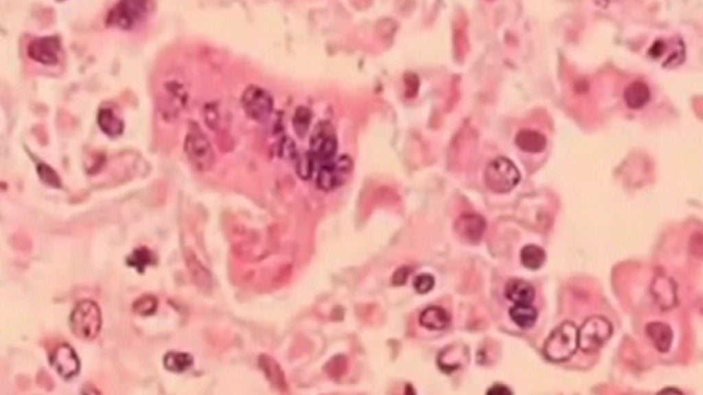 Surto de sarampo em Portugal