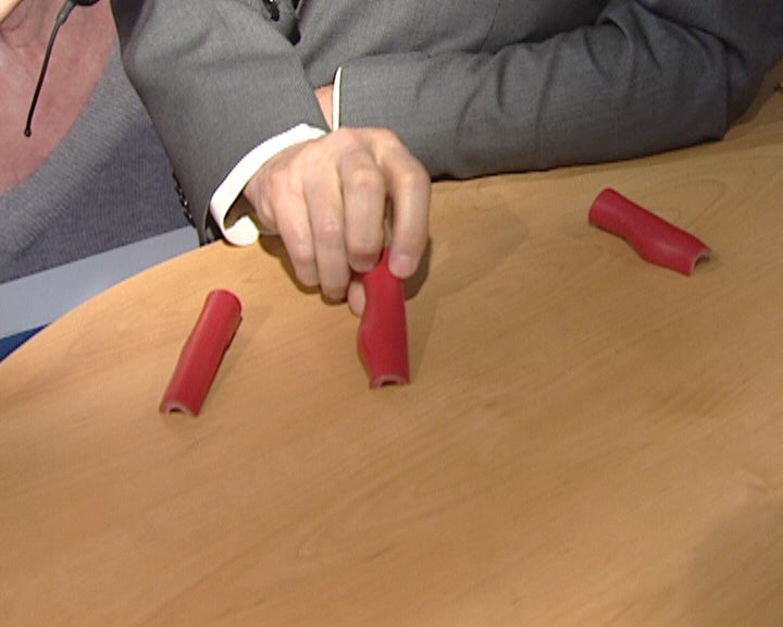 Doenças cardiovasculares