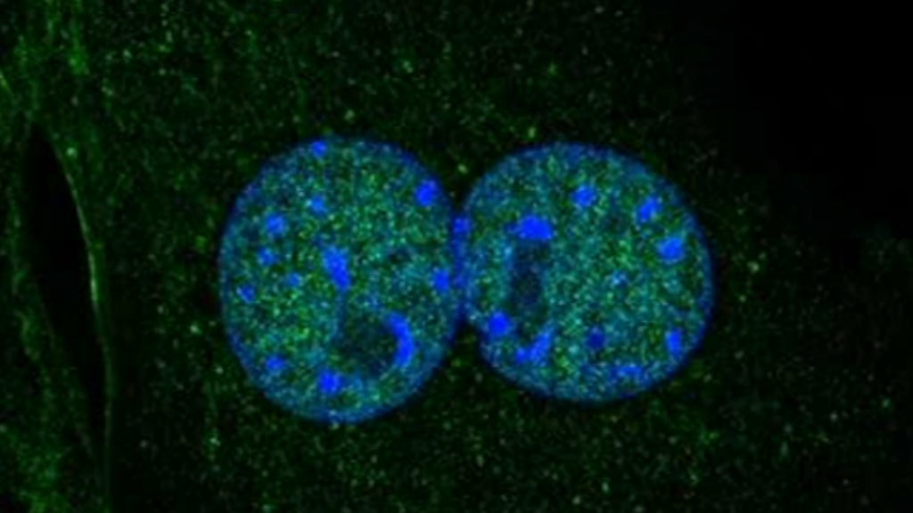 Reverter o envelhecimento