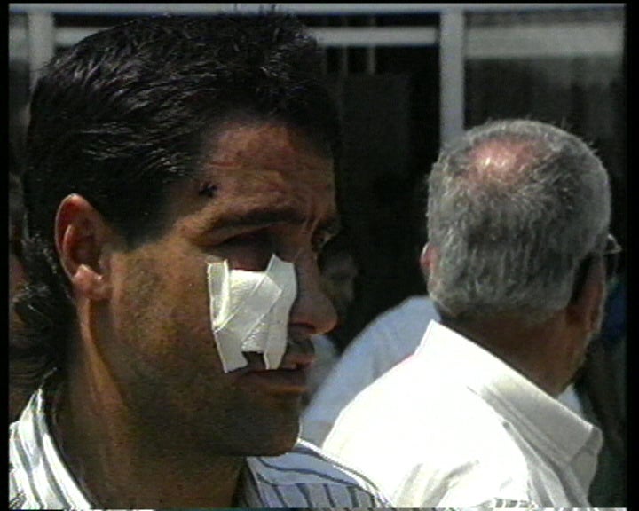 Nando baleado no Brasil