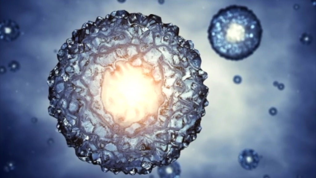 Avanços na luta contra o VIH SIDA