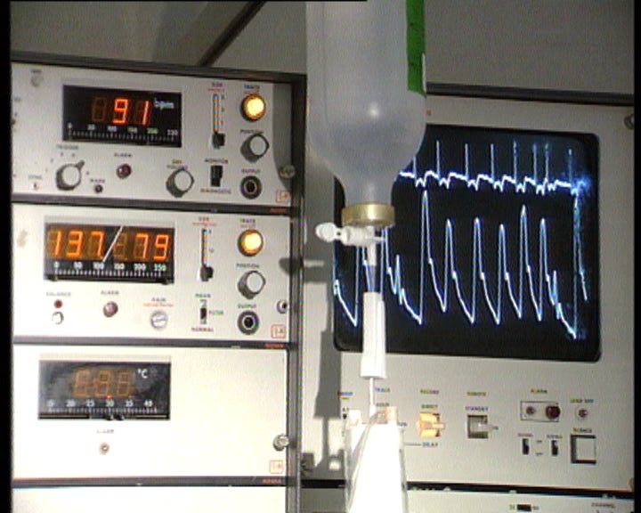 Morte de hemodialisado em Évora