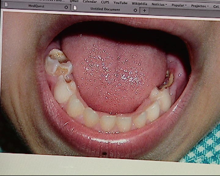 Projecto piloto de diagnóstico de saúde oral à distancia