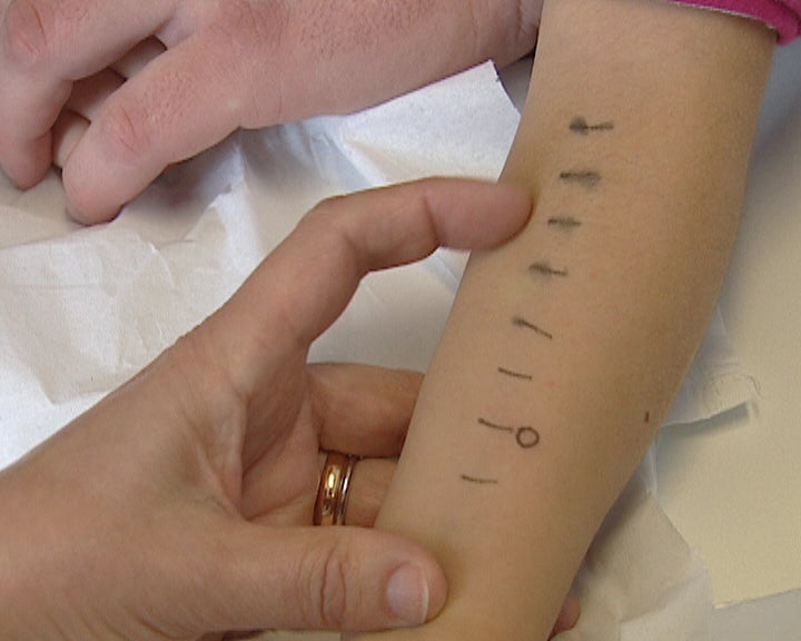 Alergias da Primavera