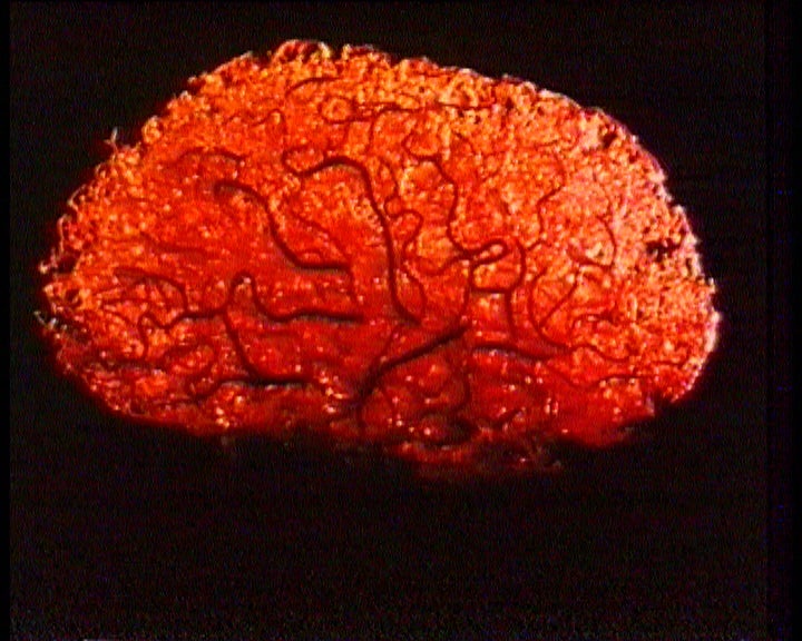 Viver Com Saúde – Episódio 46