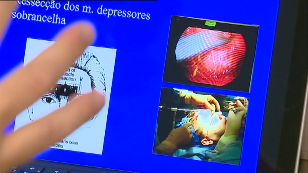 Tratamento da enxaqueca