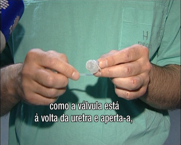 Cirurgia da incontinência urinária
