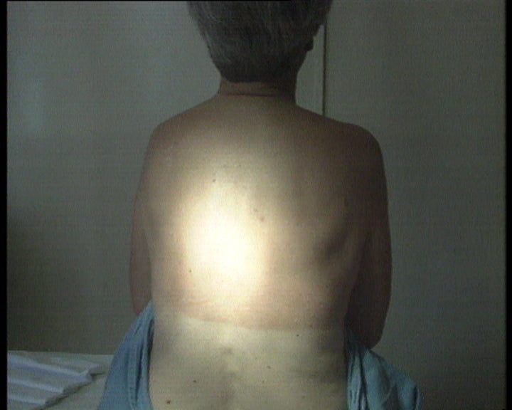 Rastreio do cancro da pele