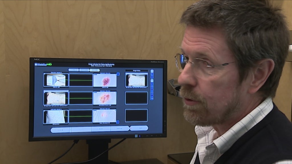 Prevenção do cancro da pele