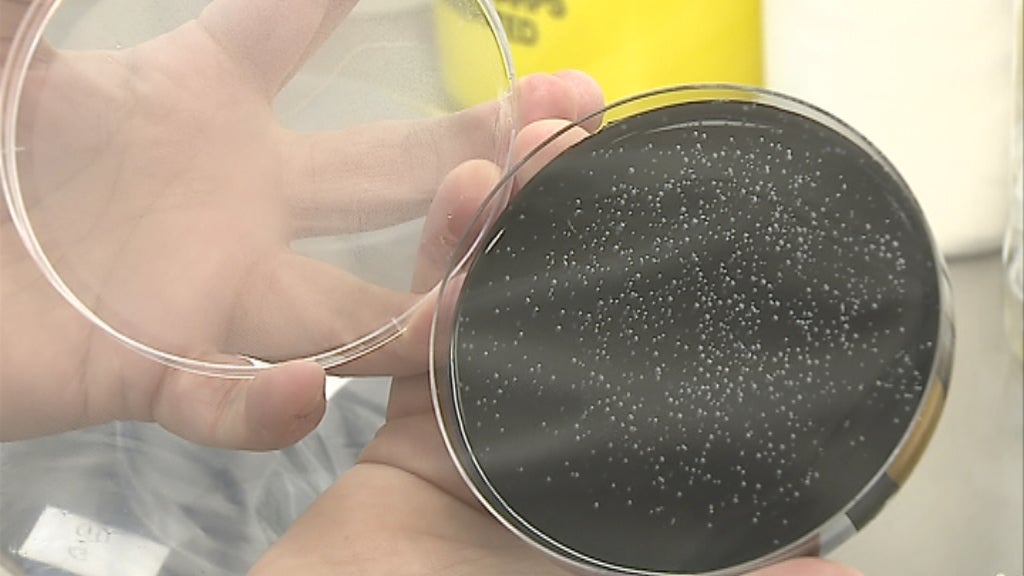 Balanço do surto de legionella em 2017