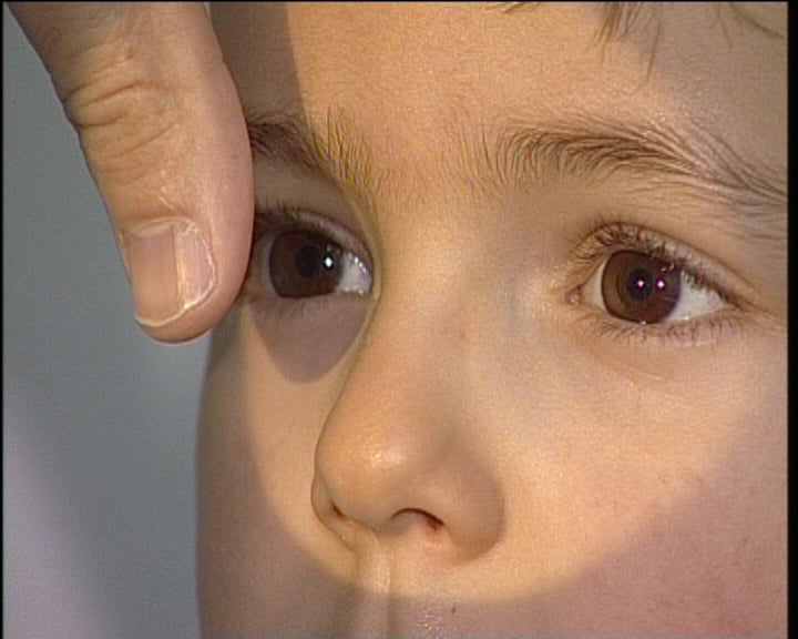 Consulta de oftalmologista pediátrica