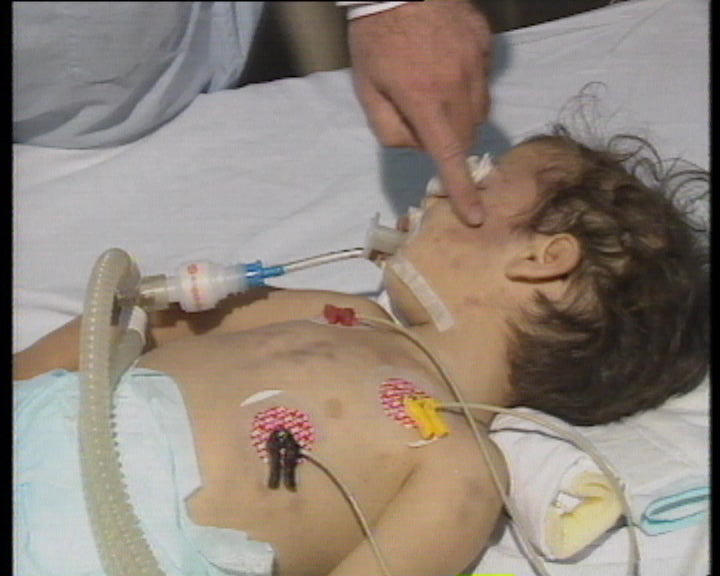 Espancamento de criança