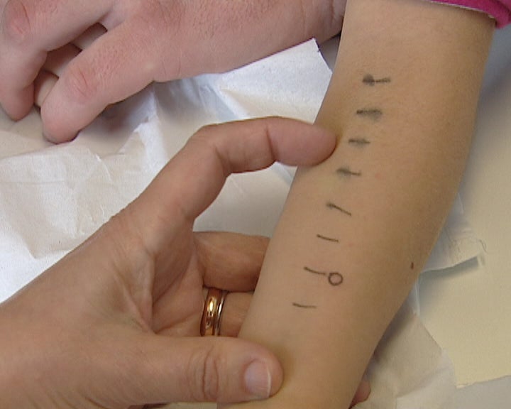 Agravamento das alergias primaveris