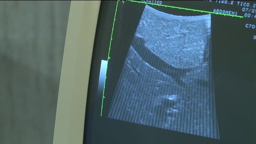 Emigração de médicos portugueses