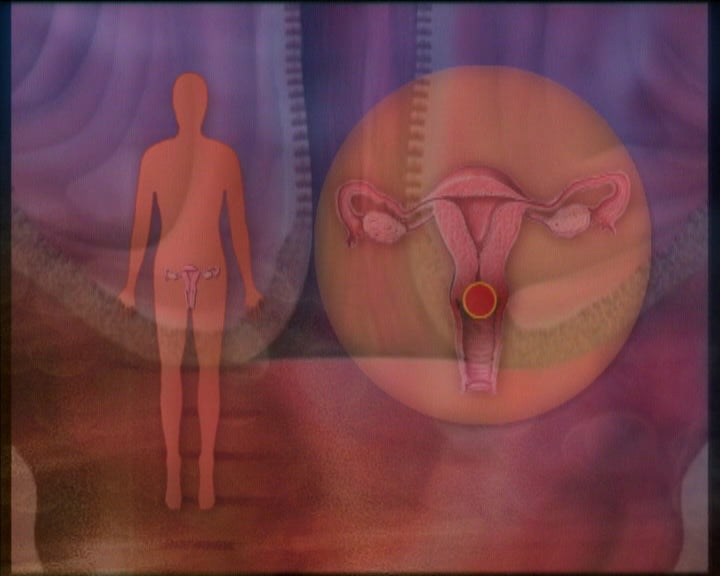 Estudo do HPV – Papilomavírus Humano