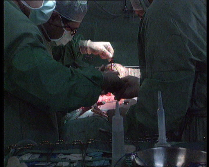 Abertura do Registo Nacional de Não Dador