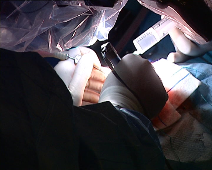 Cirurgia inovadora no Hospital de São João