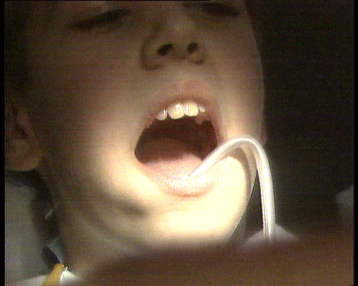 Dentistas portugueses contra brasileiros