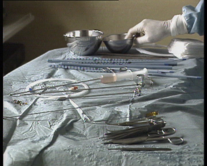 Comércio de órgãos