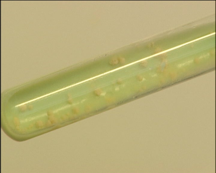 Dia mundial da tuberculose